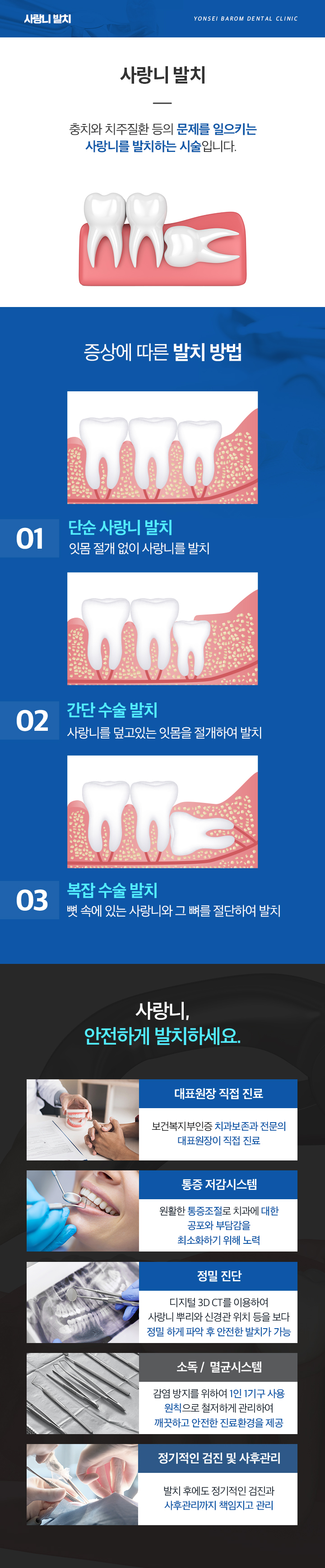 사랑니발치